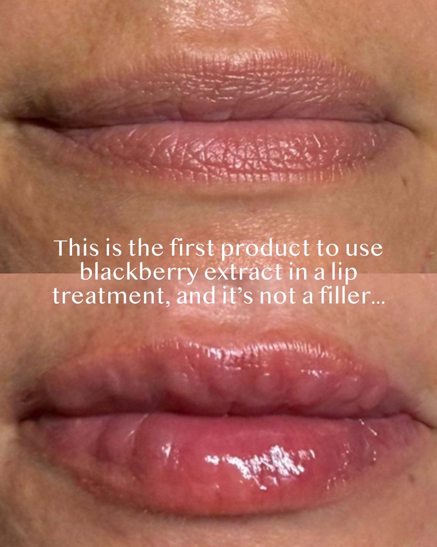 Close-up of lips with a text overlay about blackberry extract lip treatment.