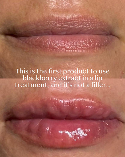 Close-up of lips with a text overlay about blackberry extract lip treatment.