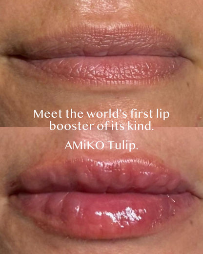 Close-up of lips with text 'Meet the world's first lip booster of its kind. AMiKO Tulip.'